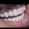 محمد بركات (سوريا 💚 السعودية ) profil fotoğrafı
