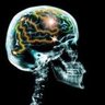 Фото профиля epilepsy facts & opinions (minds of an epileptic)