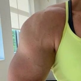 重度肌肉女患者's profile picture