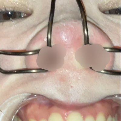 nosehooknose's profile picture