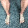Skintypoos 的头像