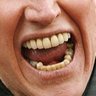 Gary Busey's Teeth's profile picture