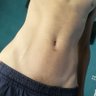 twinkleo profil fotoğrafı