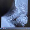 Bionic Redneck profil fotoğrafı