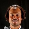 Profilbild von Matthews hairline