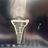X-Ray Vision 🇺🇸🇺🇸🇺🇸 profil fotoğrafı