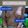 1stfillerha.ind 的头像