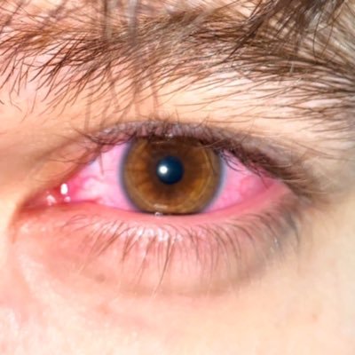 Clonazepam 👁's profile picture