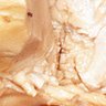 Profilbild von Amygdala Subdivisions