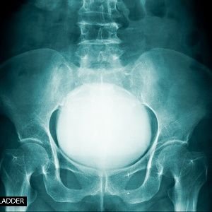 Karliecanthold's profile picture