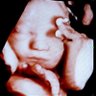 Mary profil fotoğrafı