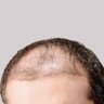 Profilbild von Ilya Sutskever's hairline