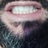 Alexandre 🚩👁️🌐👁️ 🚩 profil fotoğrafı