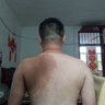 我有一块长毛的大大胎记 的头像