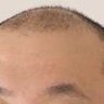 配達員から搾取した金で植毛しています's profile picture