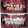 Implantsandbraces.ke's profile picture