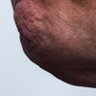 Zoomed in Photo of Trumps Chin's profile picture