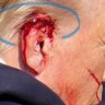 Фото профиля Fake Ear Injury