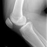 Фото профиля Bonyknee