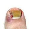 Фото профиля ingrown.toenail