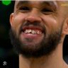 Derrick White’s tooth's profile picture