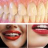 Фото профиля 🦷love dental 🦷