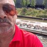Laxman profil fotoğrafı