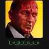 Leprosy profil fotoฤrafฤฑ