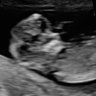 Profilbild von RJ
