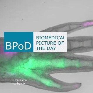Biomedical Picture of the Day BPoD's profile picture