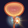 Oncoprostatelog's profile picture