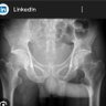 Фото профиля Aldo Valles