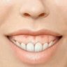 Sorriso Gengival 的头像
