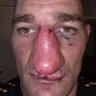 Unga bunga MMA profil fotoğrafı