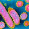 Фото профиля Erysipelothrix rhusiopathiae