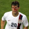 Profilbild von Bronsolinho