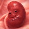 Profilbild von Hearty