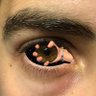 Redeye 的头像