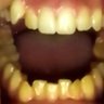 teeth profil fotoğrafı