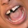 Chriseans Missing Tooth 的头像