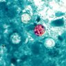 Фото профиля Cyclosporiasis