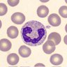 🦠Neutrophil🦠 Resident follyologist's profile picture