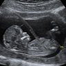 Maple's unborn child profil fotoğrafı
