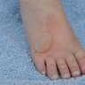 Renegade Blister's profile picture