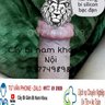 Găm Bi - Cắt Bao Quy Đầu Tại Hà Nội 的头像