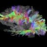 Erdos314🌏🎧🔬🦉📚#ActuallyAutistic's profile picture
