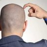 وشوووله profil fotoğrafı