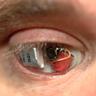 Rob Spence Eyeborg's profile picture
