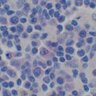 Фото профиля Bartonellose