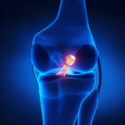 ACL Recovery Club's profile picture